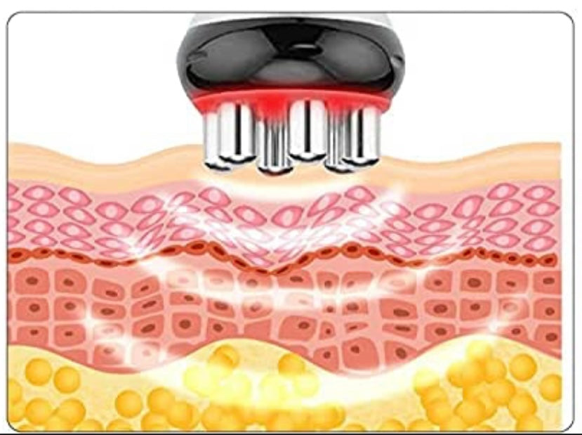 Radio Frequency Body Contouring: Single 30 min Session
